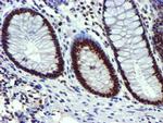 USP7 Antibody in Immunohistochemistry (Paraffin) (IHC (P))