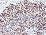 USP7 Antibody in Immunohistochemistry (Paraffin) (IHC (P))