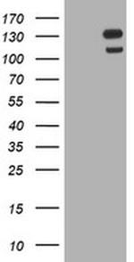 USP7 Antibody in Western Blot (WB)