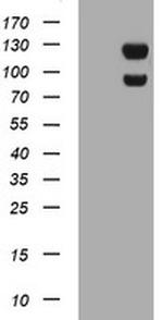 USP7 Antibody in Western Blot (WB)