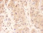 USP8 Antibody in Immunohistochemistry (IHC)