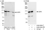 USP8 Antibody in Western Blot (WB)