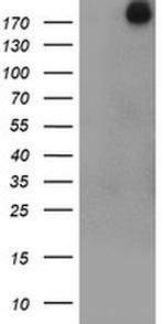 USP9X Antibody in Western Blot (WB)