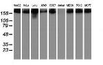 USP9X Antibody in Western Blot (WB)