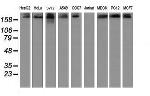 USP9X Antibody in Western Blot (WB)