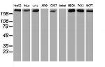 USP9X Antibody in Western Blot (WB)