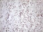 UTP11L Antibody in Immunohistochemistry (Paraffin) (IHC (P))