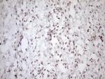 UTP11L Antibody in Immunohistochemistry (Paraffin) (IHC (P))