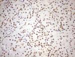 UTP11L Antibody in Immunohistochemistry (Paraffin) (IHC (P))