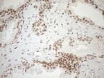 UTP11L Antibody in Immunohistochemistry (Paraffin) (IHC (P))