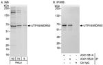 UTP18/WDR50 Antibody in Western Blot (WB)