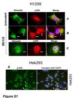 Ubiquitin Antibody in Immunocytochemistry (ICC/IF)