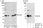 VAPB Antibody in Western Blot (WB)