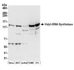 Valyl-tRNA Synthetase/VARS Antibody in Western Blot (WB)
