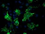 VASP Antibody in Immunocytochemistry (ICC/IF)