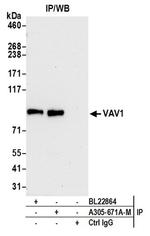 VAV1 Antibody in Western Blot (WB)