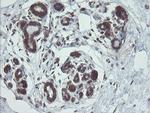 VBP1 Antibody in Immunohistochemistry (Paraffin) (IHC (P))