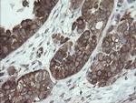 VBP1 Antibody in Immunohistochemistry (Paraffin) (IHC (P))