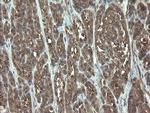 VBP1 Antibody in Immunohistochemistry (Paraffin) (IHC (P))