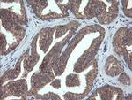 VBP1 Antibody in Immunohistochemistry (Paraffin) (IHC (P))