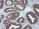 VBP1 Antibody in Immunohistochemistry (Paraffin) (IHC (P))