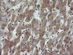 VBP1 Antibody in Immunohistochemistry (Paraffin) (IHC (P))