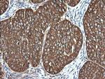 VBP1 Antibody in Immunohistochemistry (Paraffin) (IHC (P))