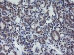 VBP1 Antibody in Immunohistochemistry (Paraffin) (IHC (P))