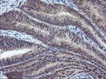 VBP1 Antibody in Immunohistochemistry (Paraffin) (IHC (P))