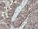 VBP1 Antibody in Immunohistochemistry (Paraffin) (IHC (P))