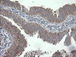 VBP1 Antibody in Immunohistochemistry (Paraffin) (IHC (P))