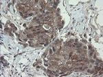 VBP1 Antibody in Immunohistochemistry (Paraffin) (IHC (P))