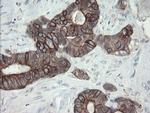 VBP1 Antibody in Immunohistochemistry (Paraffin) (IHC (P))