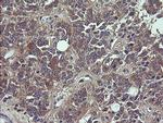 VBP1 Antibody in Immunohistochemistry (Paraffin) (IHC (P))