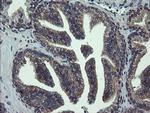 VBP1 Antibody in Immunohistochemistry (Paraffin) (IHC (P))