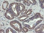 VBP1 Antibody in Immunohistochemistry (Paraffin) (IHC (P))