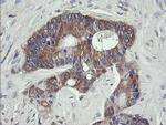 VBP1 Antibody in Immunohistochemistry (Paraffin) (IHC (P))