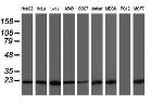 VBP1 Antibody in Western Blot (WB)