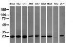 VBP1 Antibody in Western Blot (WB)