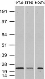 VBP1 Antibody in Western Blot (WB)