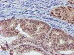 VCAM1 Antibody in Immunohistochemistry (Paraffin) (IHC (P))