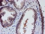 VCAM1 Antibody in Immunohistochemistry (Paraffin) (IHC (P))