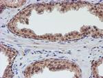 VCAM1 Antibody in Immunohistochemistry (Paraffin) (IHC (P))