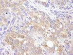 VCIP135 Antibody in Immunohistochemistry (IHC)