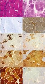 VCP Antibody in Immunohistochemistry (IHC)