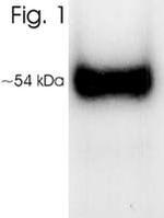 VDR Antibody in Western Blot (WB)