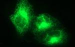 VEGFB Antibody in Immunocytochemistry (ICC/IF)