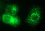 VEGFB Antibody in Immunocytochemistry (ICC/IF)