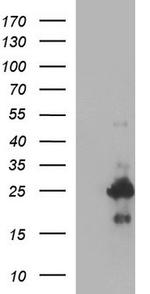 VEGFB Antibody in Western Blot (WB)