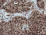 VHL Antibody in Immunohistochemistry (Paraffin) (IHC (P))